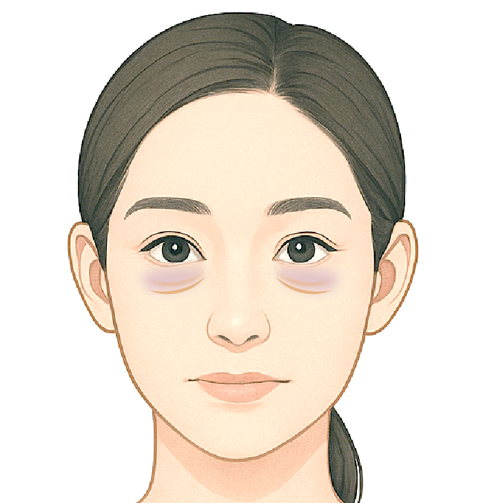 目の下が青っぽく見える場合