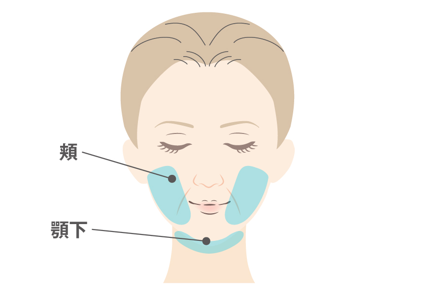 脂肪吸引の吸引範囲