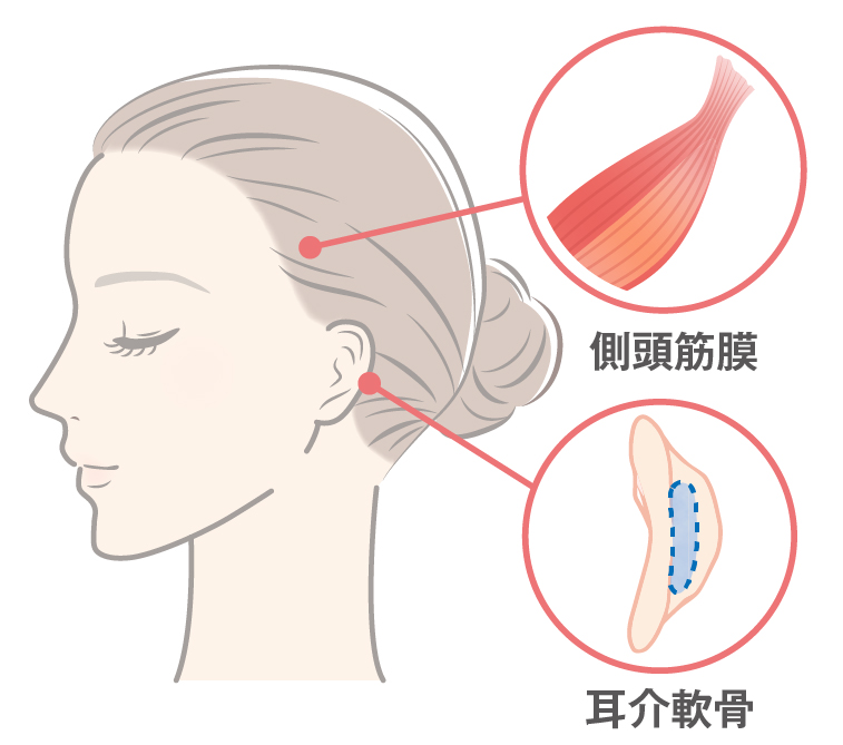 自家組織で再手術