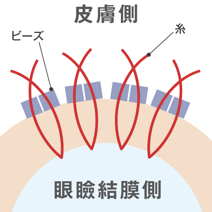 ビーズ法の特徴