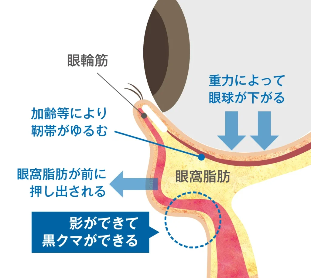 目のクマができる原因